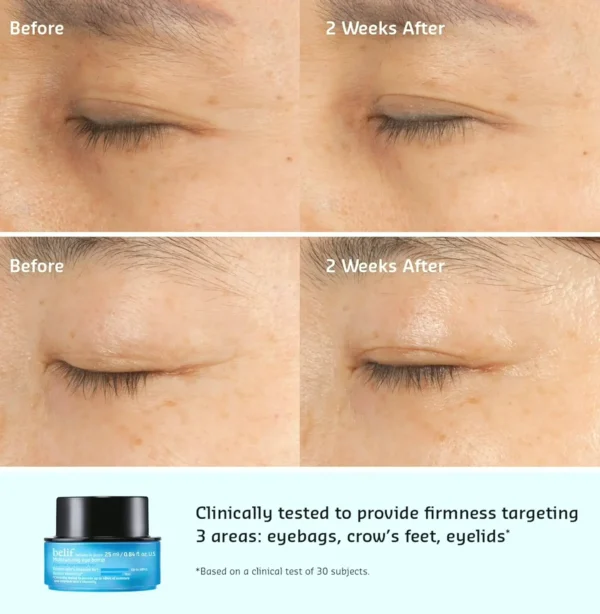 Belif Eye Bomb with Squalane for All Skin Types