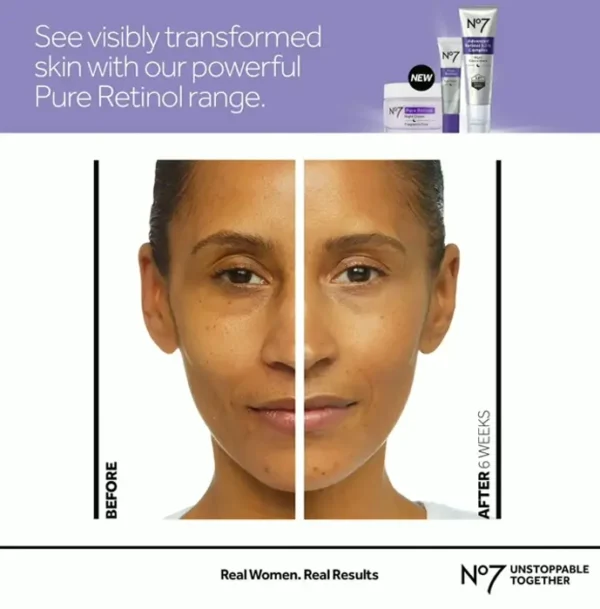 #7 Pure Retinol Under Eye Cream with Peptides and Shea for Fine Lines (0.5 oz)
