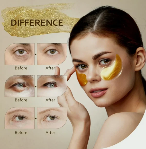Royal Gilded Under Eye Patches for Dark Circles (Thirty Sets)