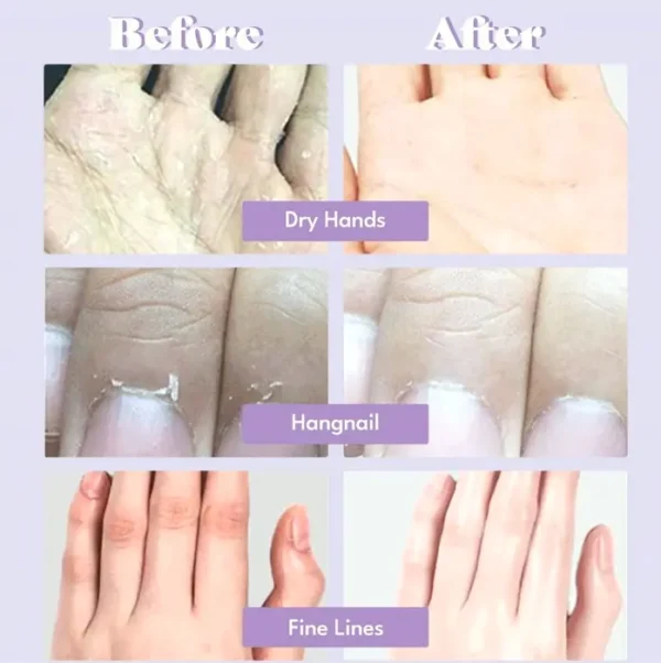 Extra Silky Hand Treatment with 5 Pairs for Dry Hands